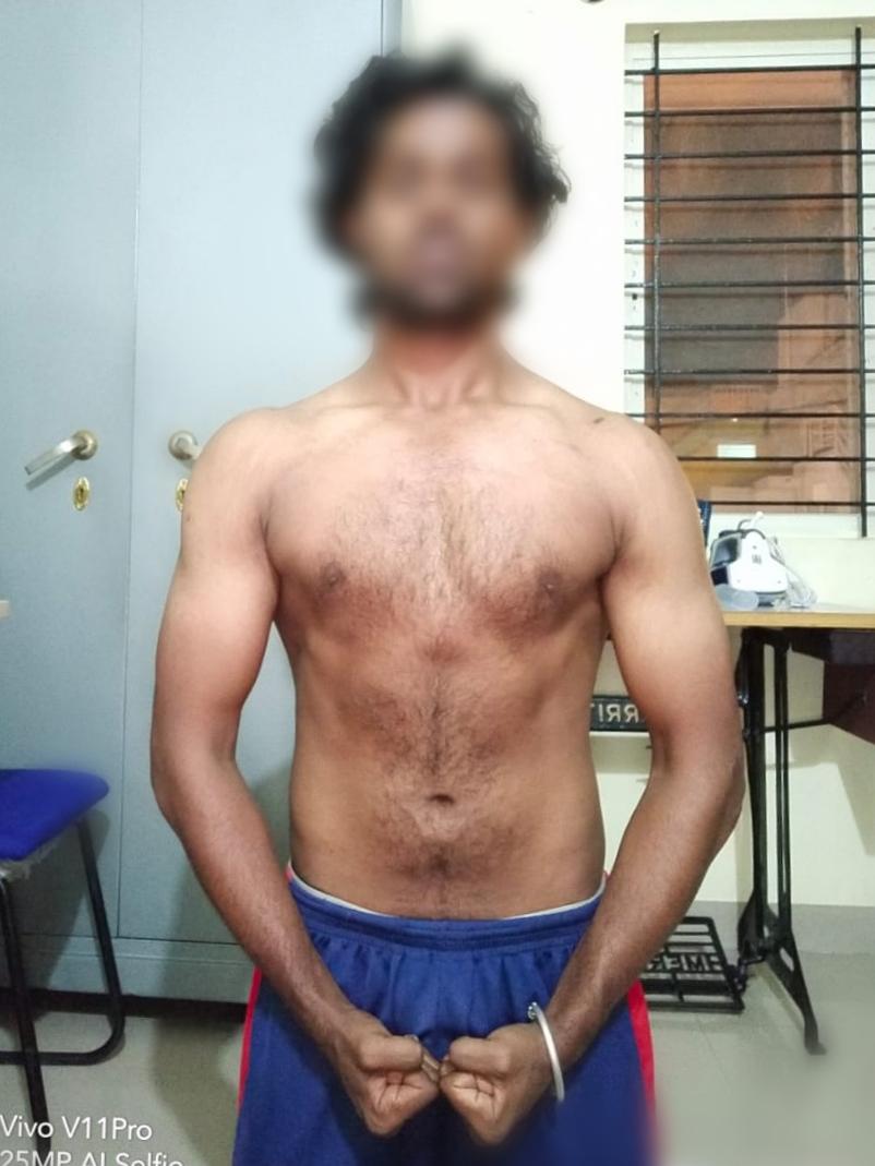 Before Transformation